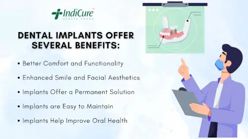 Benefits of dental implants Benefits of dental implants
